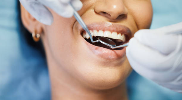 Best Emergency Dental Care for Abscessed Tooth in Red Bank, TN