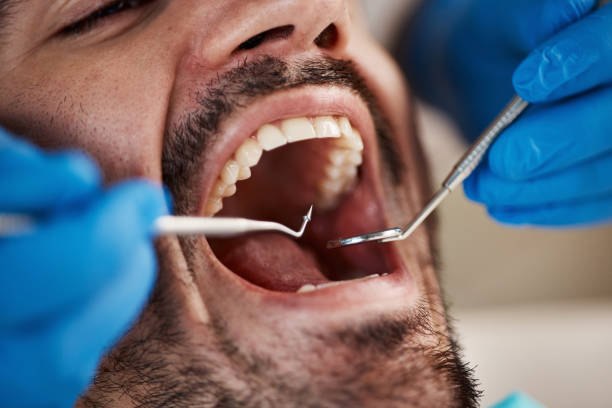 Best Emergency Dental Services for Seniors in Red Bank, TN