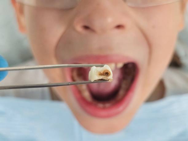 Best Mobile Emergency Dentist in Red Bank, TN
