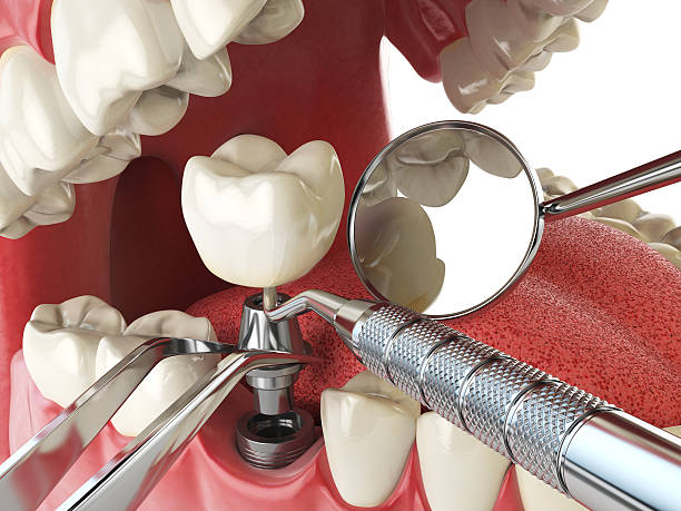 Best Emergency Cosmetic Dentistry in Red Bank, TN